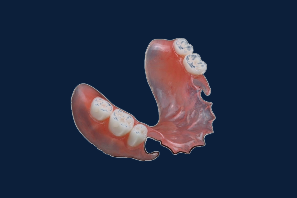 Flexible Partial